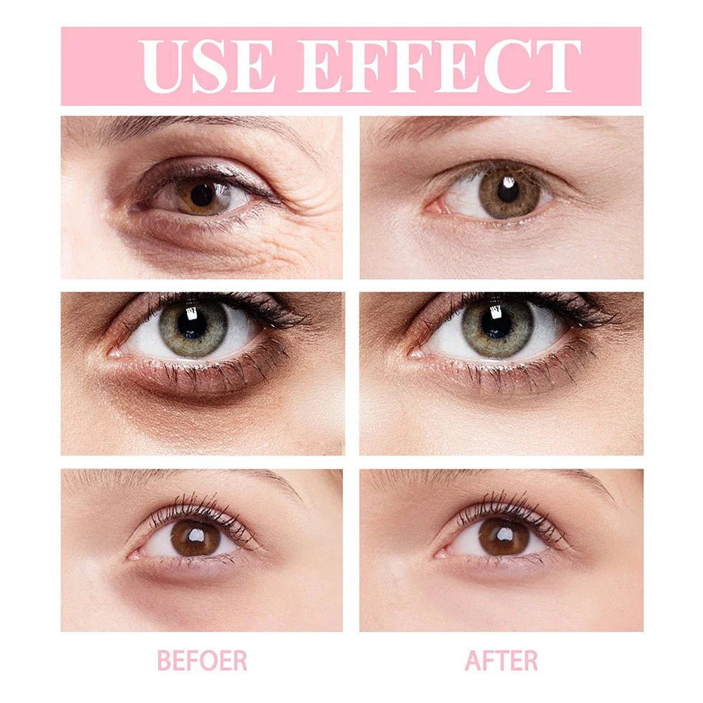 CREME ROLL-ON PARA ÁREA DOS OLHOS COM RETINOL